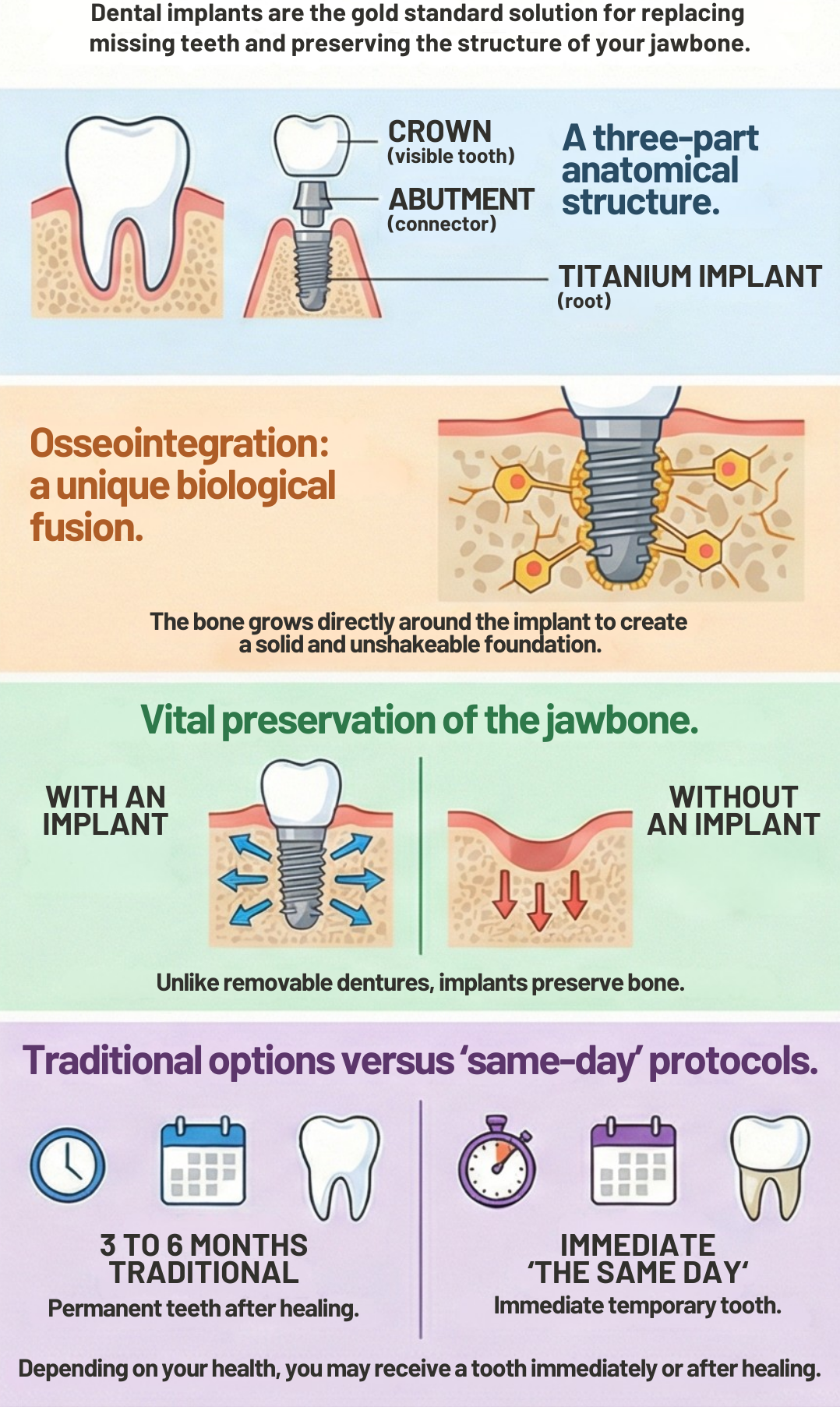 An infographic explaining what dental implants are