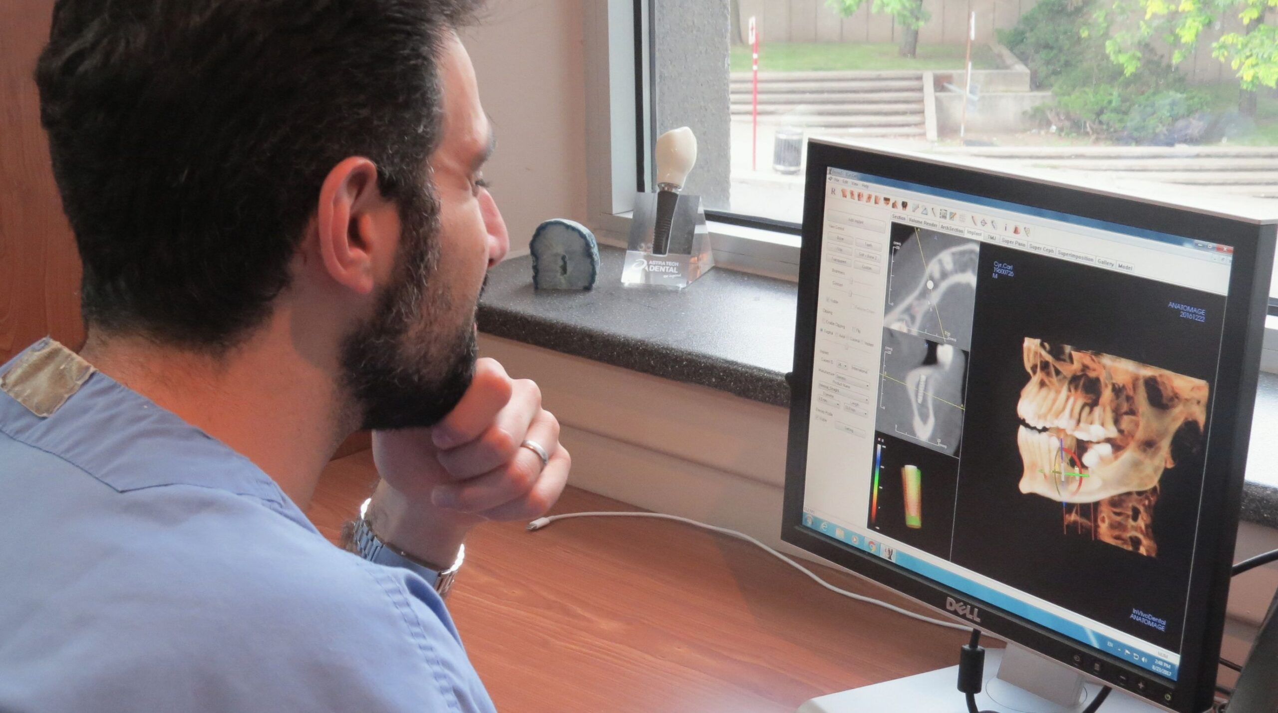 Oral surgeon reviewing 3D imaging for dental implant planning 