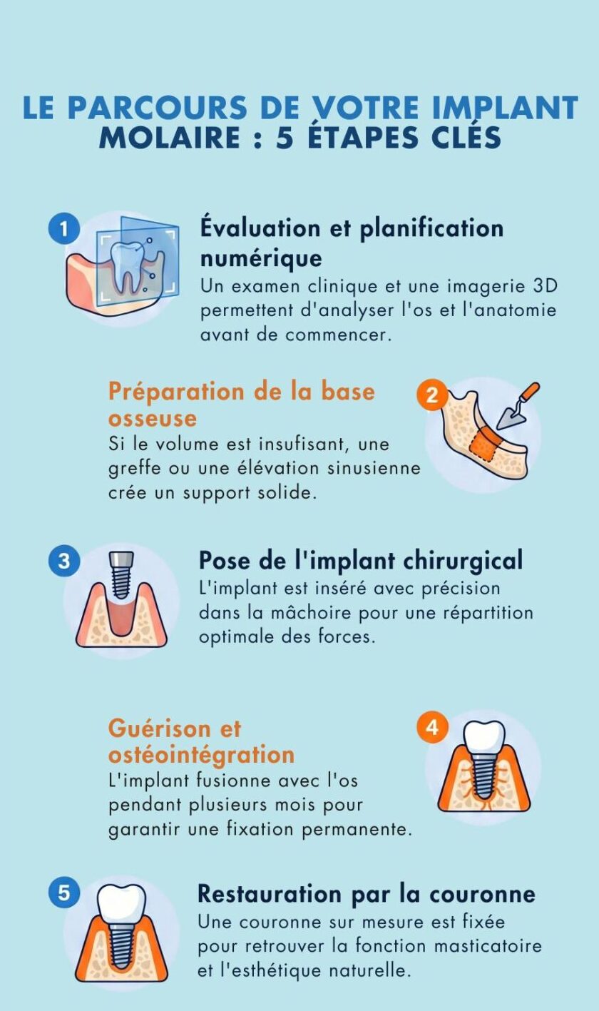 Aperçu des étapes d’un implant dentaire molaire, de la consultation à la couronne finale 