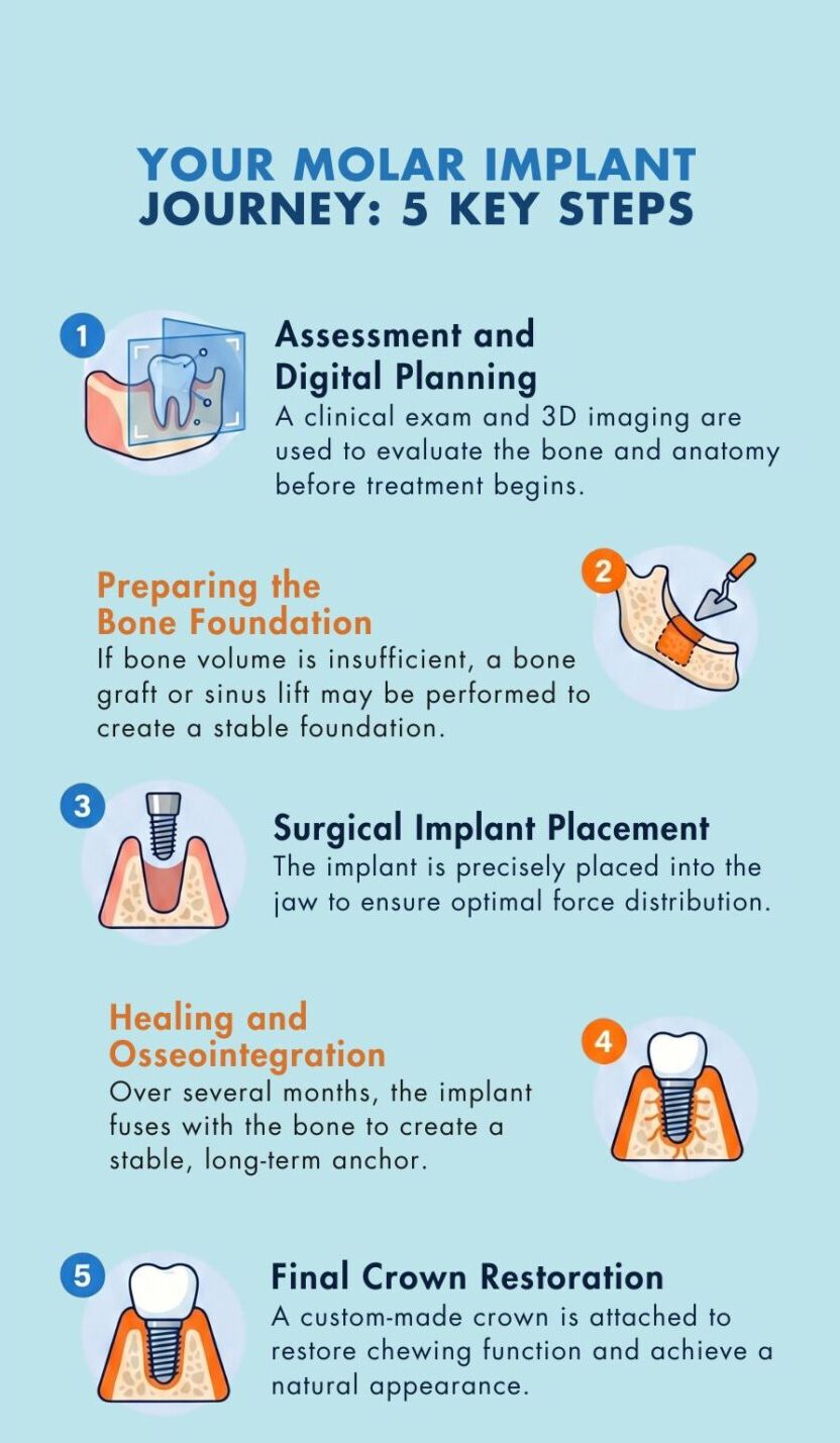 Overview of steps in a molar dental implant procedure from consultation to final crown 