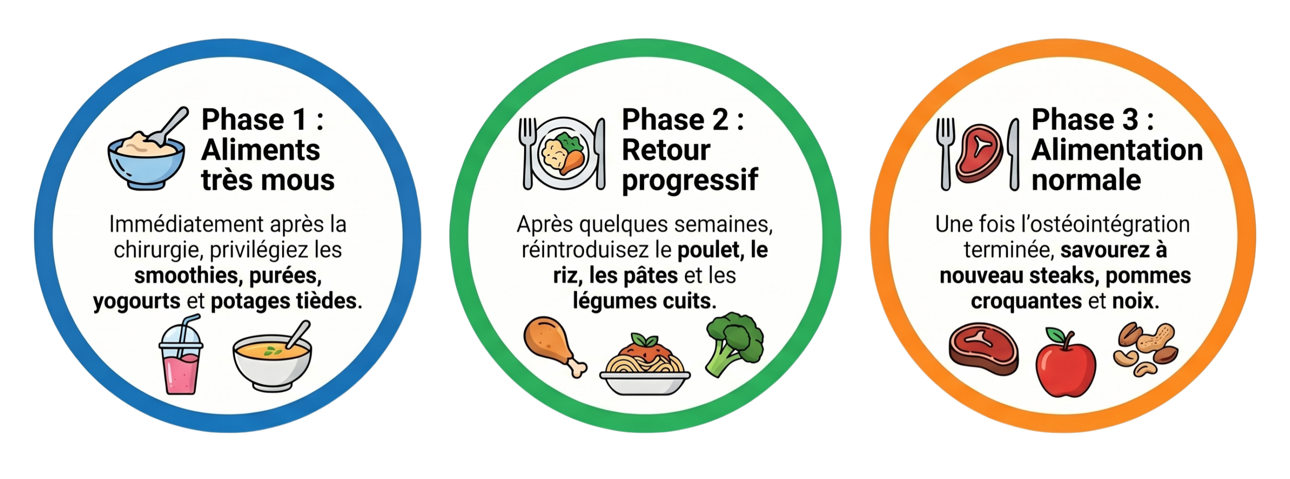 Infographie montrant l’alimentation recommandée immédiatement après la chirurgie, l’introduction progressive de certains aliments, puis les options alimentaires à long terme.