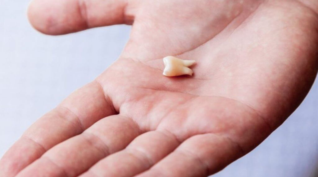 Adult holding a knocked-out permanent tooth after a dental injury
