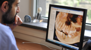 Oral surgeon discussing options for replacing a missing tooth during a consultation in Montreal.