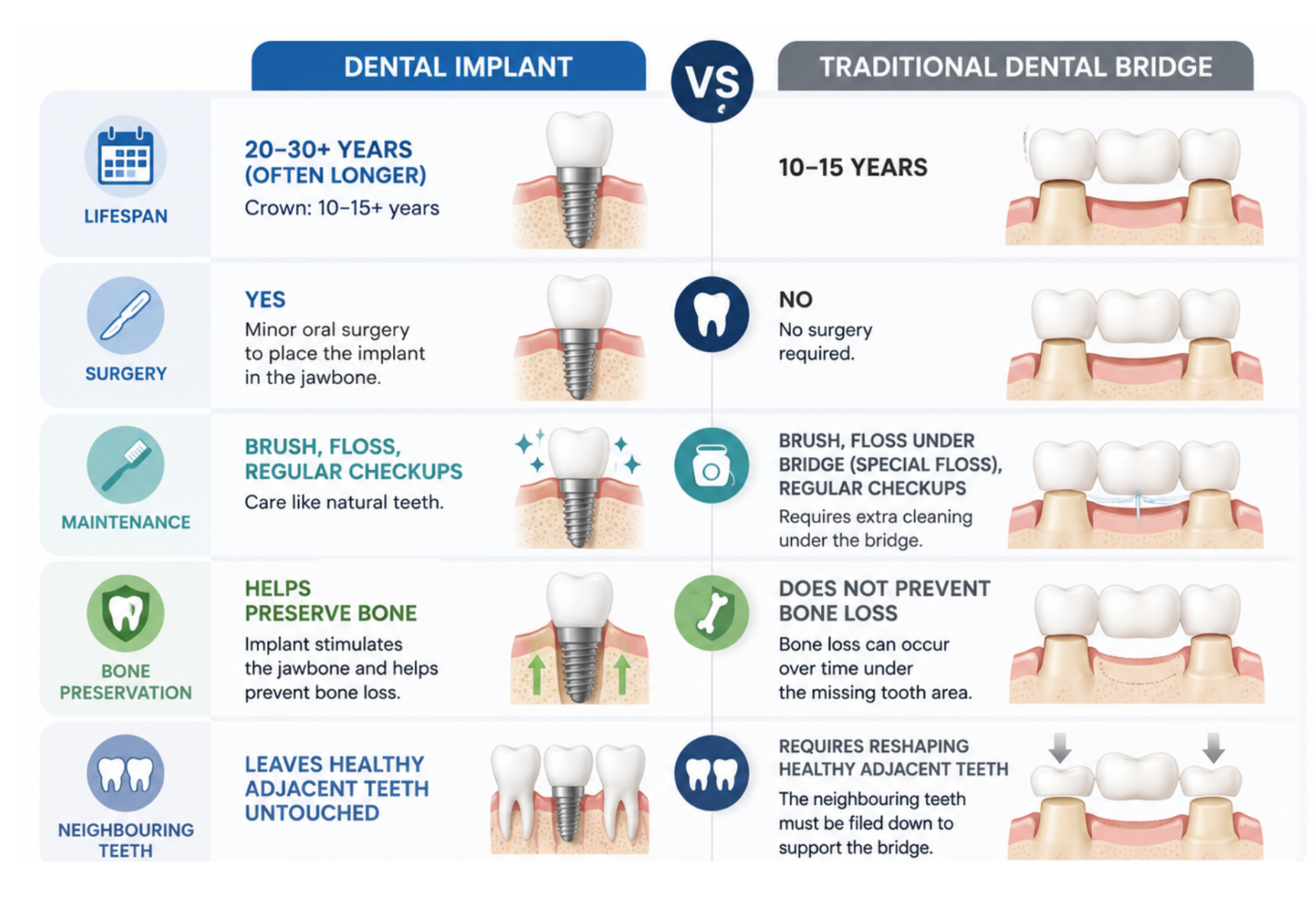 Side-by-side comparison of a dental implant and a traditional dental bridge.